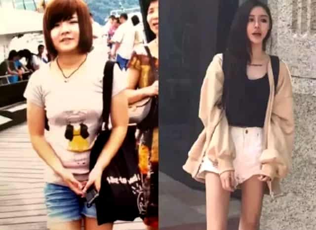 肠梗阻住院了医生会查明什么原因引起的吗